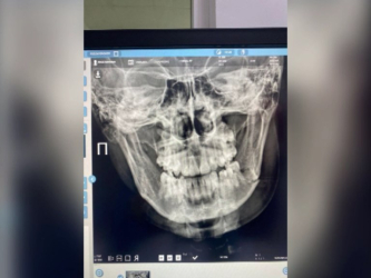 Мать избитого подростка добивается справедливости